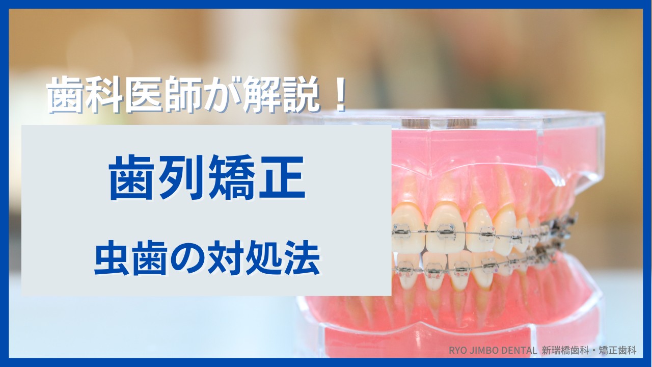 矯正中に虫歯を発見したら治療はどうする？