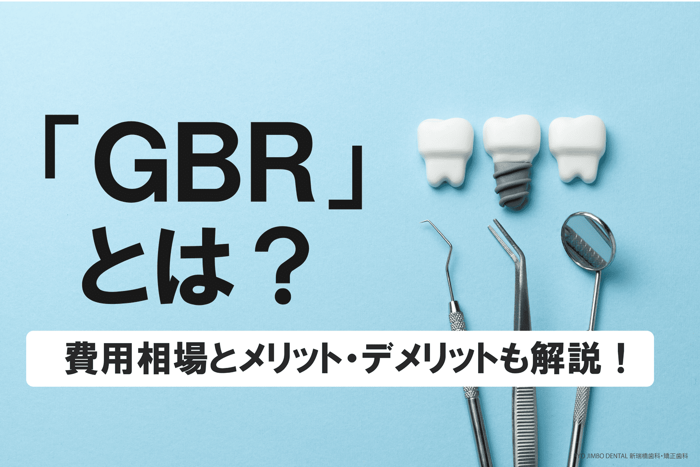 GBRとは？不可と言われた方のインプラントを可能にする治療法と費用相場は？